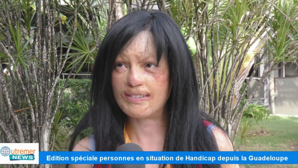 [Vidéo] GUADELOUPE. Colloque L inclusion des personnes en situation de handicap (3ème)